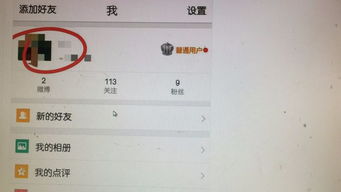 为什么微博改不了昵称 