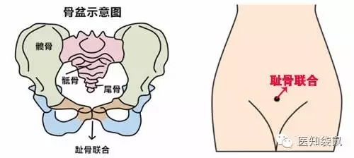 女性耻骨联合的位置图 搜狗图片搜索