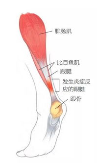 跑步受伤了怎么办 不要慌 首先我们要做好应急措施