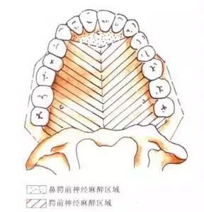 口腔颌面外科学常用麻醉方法 