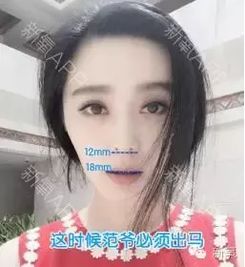 金星老师医美讲堂 女星整出来的翘鼻,怎么会这 