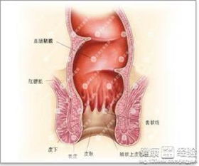 痔疮与肛门脓肿有什么区别