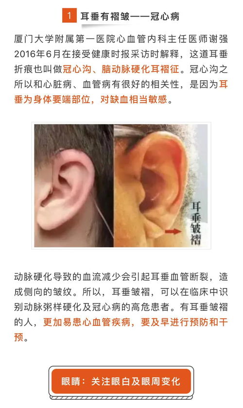 男人的耳垂低于鼻头的面相