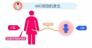 夫妻血型不合易流产 现在结婚还要看血型