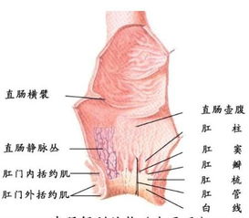 肛门出血