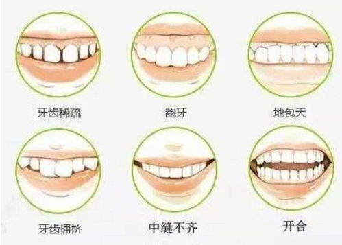 聊聊牙齿矫正这点事,听陈丹鹏教授怎么说