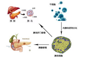 干细胞 走在糖尿病治疗前沿的新希望