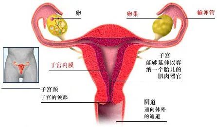 子宫内膜异位(子宫异位症是什么)