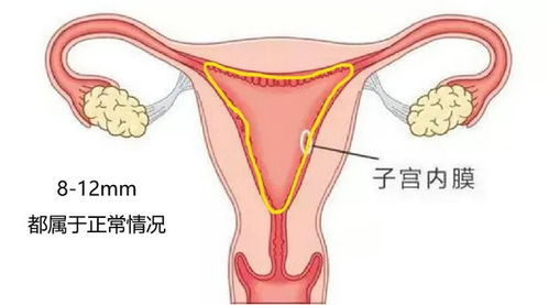 什么因素会导致子宫内膜薄？在试管中会产生什么影响？