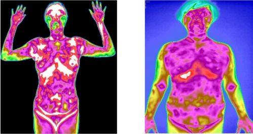 红外热成像技术人体