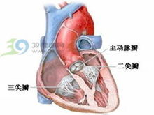 二尖瓣脱垂修复手术麻烦吗 