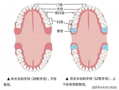 你的智齿要拔吗 植得医生 看完这篇就会有答案