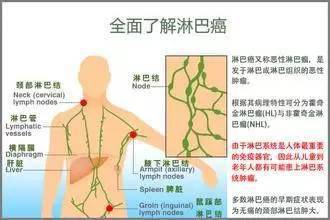 美丽的 负担 ,颈部淋巴为你承担了多少