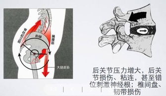 腰痛到底适不适合小燕飞