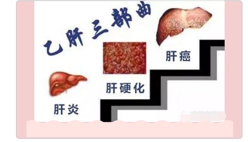 干细胞的作用,干细胞治疗肝病成为有可能,不再 谈肝色变