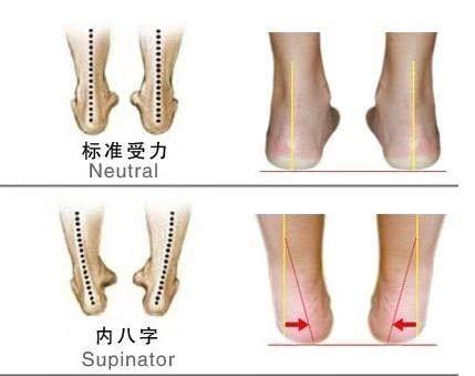 腿型矫正系列 超模腿型养成记,X腿改善就用这招