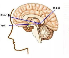 脑仁 中央生肿瘤,360度全死角的手术怎么办 