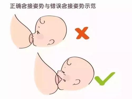 树袋宝宝 哺乳期乳头皲裂 又疼又影响哺乳,怎么办