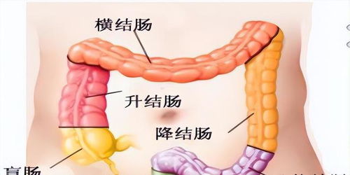 息肉是肠癌最大祸根,长了肠息肉,身体或有3个 警报