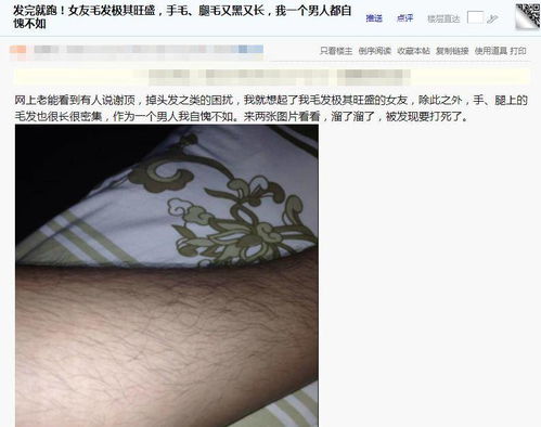 厦门网友吐槽 女友毛发极其旺盛,手毛 腿毛又黑又长,我一个男人都自愧不如啊