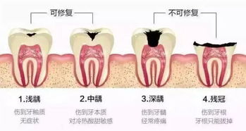 门牙摔断了，根管治疗换药4-5次了，是什么原因