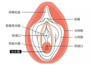 绝对的处女 无孔处女膜