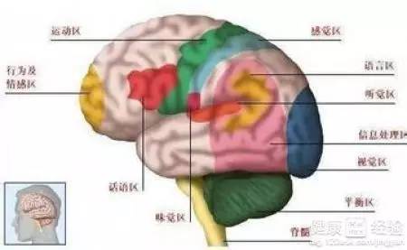 专家推荐 脑出血手术后应该做哪些康复治疗 