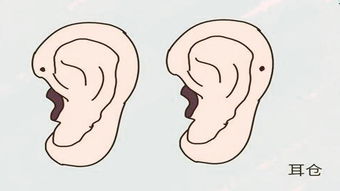 宝宝耳朵前有一小孔,有人说这是大富大贵的相,这是真的吗 