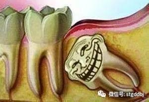 智齿坏了一定需要拔掉吗(智齿坏了一定需要拔掉吗多少钱)