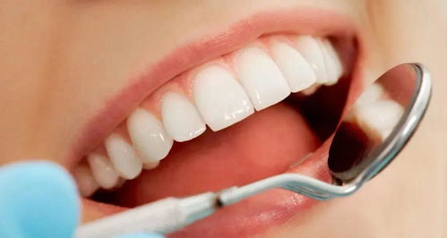 朴洁牙片 吃哪些食物能口气清新