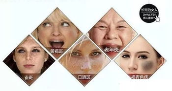 以上这8种女人脸上容易长斑,快看看有没有你 