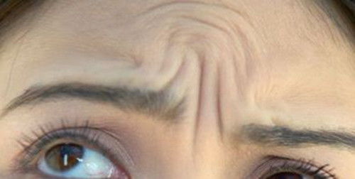眉间有皱纹的面相象征着什么含义