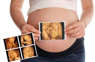 怀孕6个月四维彩超(怀孕6个月四维彩超检查注意事项有哪些)