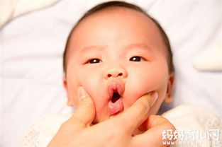 初生婴儿嘴唇脱皮正常吗 如何护理宝宝嘴唇脱皮 2