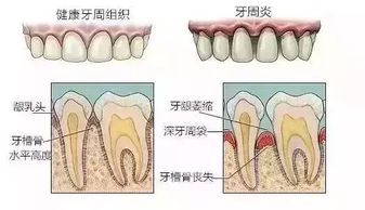 牙缝太大会漏财,可有 逆天改命 的补救方法 