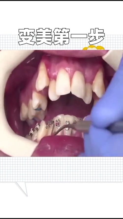 你的牙齿整齐吗 拥有整齐的牙齿是种什么体验呢 