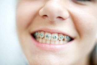 宝宝牙齿畸形影响整体颜值怎么办 儿童牙齿畸形到底应该怎么做