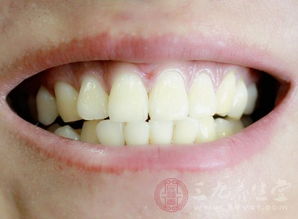 为什么网上好多人牙齿很白，是怎么变白的