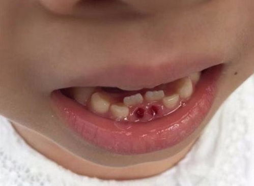 医生建议 别这样给娃吃水果,真的对牙不好,还影响孩子身体发育