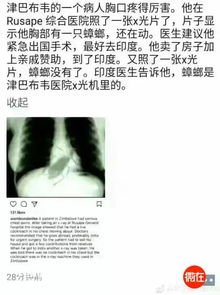 冷知识蟑螂辐射(蟑螂影响人的健康吗)