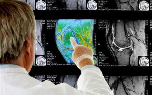 MRI磁共振检查流程是什么 你或许真不知道,今天来告诉各位答案