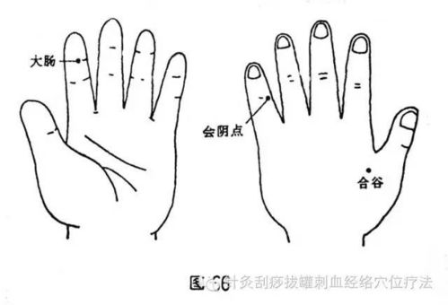 痔疮 肛门出血,刺激会阴点,立竿见影 