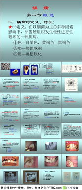 龋病的病因和致病机制毕业论文