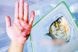 广西食人鱼连袭2人 伤者手掌血肉模糊