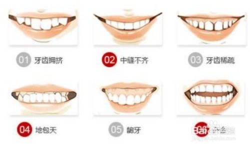 牙齿矫正北京选什么样的医生比较好