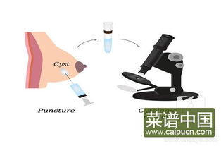 乳腺癌化疗期间菜谱有哪些