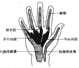 手掌肌腱粘连怎么弄好看(我该怎么加强锻炼)(手肌腱粘连怎么恢复正常)