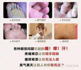日本医院推荐针对灰指甲 脚气 足廯专用抗真菌药水