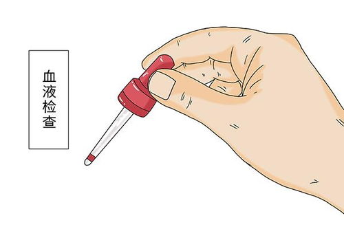 普通血常规能不能查出癌症 医生 3个指标有异常,需进一步检查