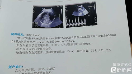 双顶径大于100还可以顺产吗